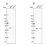 Atlas Antibodies Anti-PCBP1 Antibody