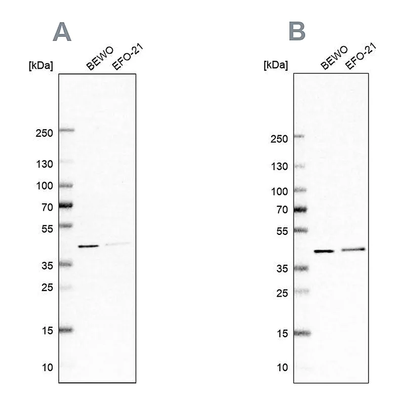 Atlas Antibodies Anti-PCBP1 Antibody