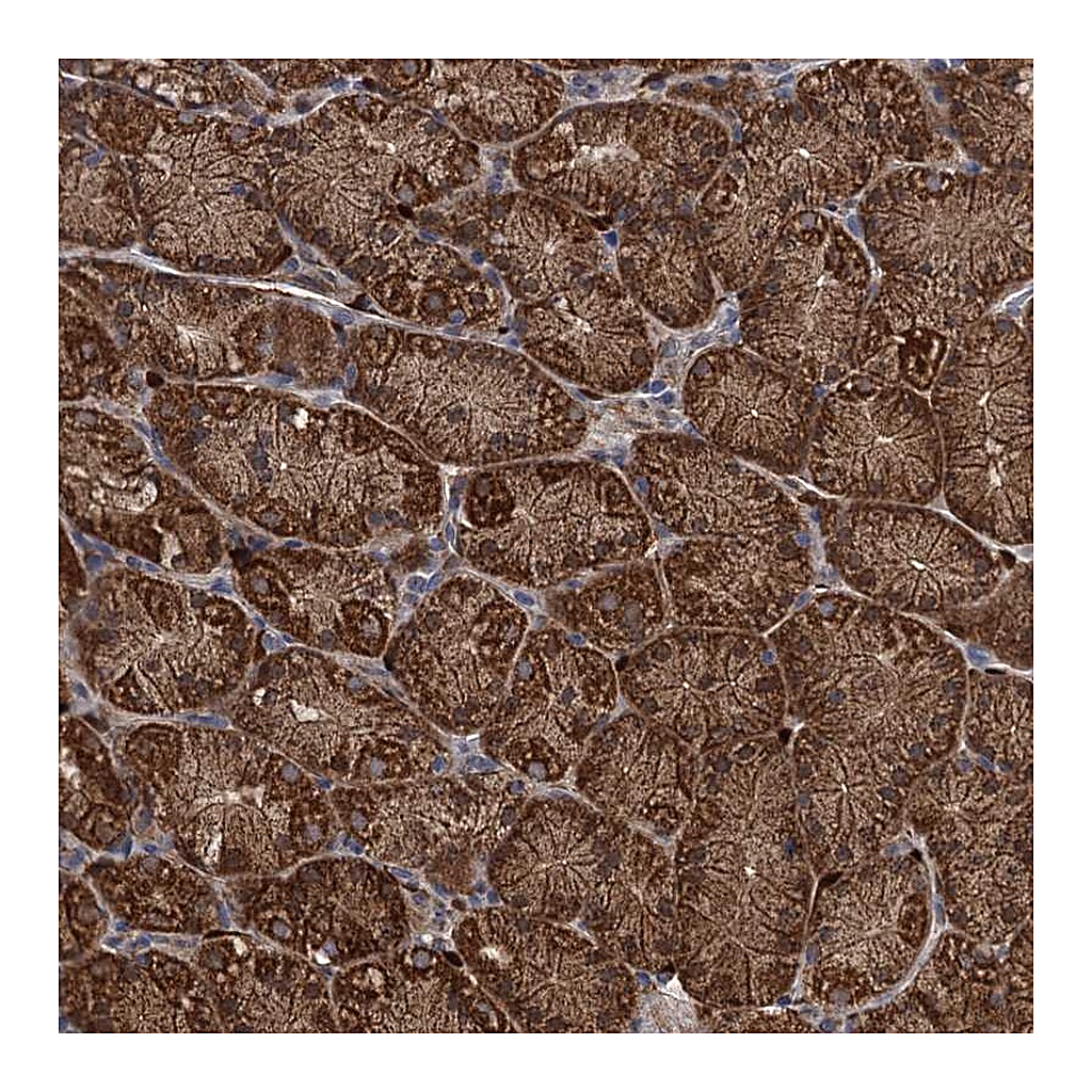 Atlas Antibodies Anti-PCCA Antibody