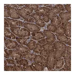 Atlas Antibodies Anti-PCCA Antibody