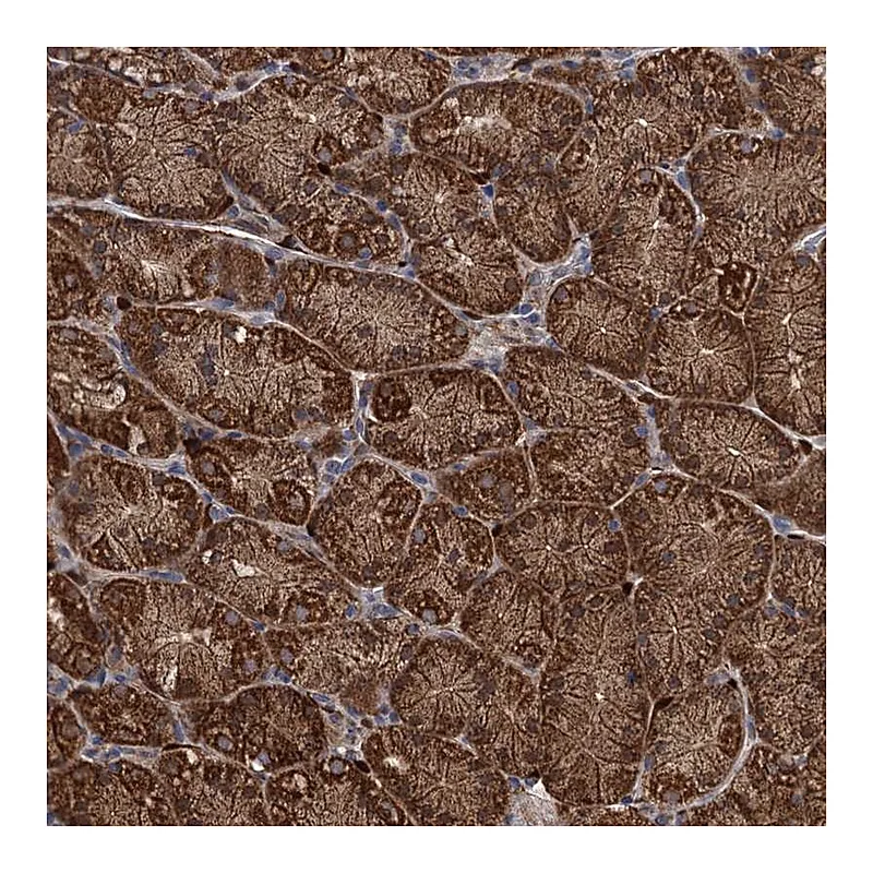 Atlas Antibodies Anti-PCCA Antibody