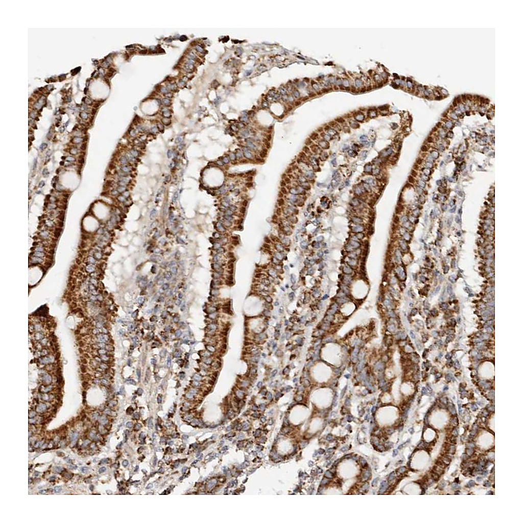 Atlas Antibodies Anti-PCBP3 Antibody