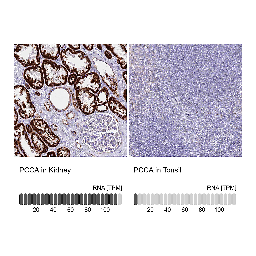 Atlas Antibodies Anti-PCCA Antibody