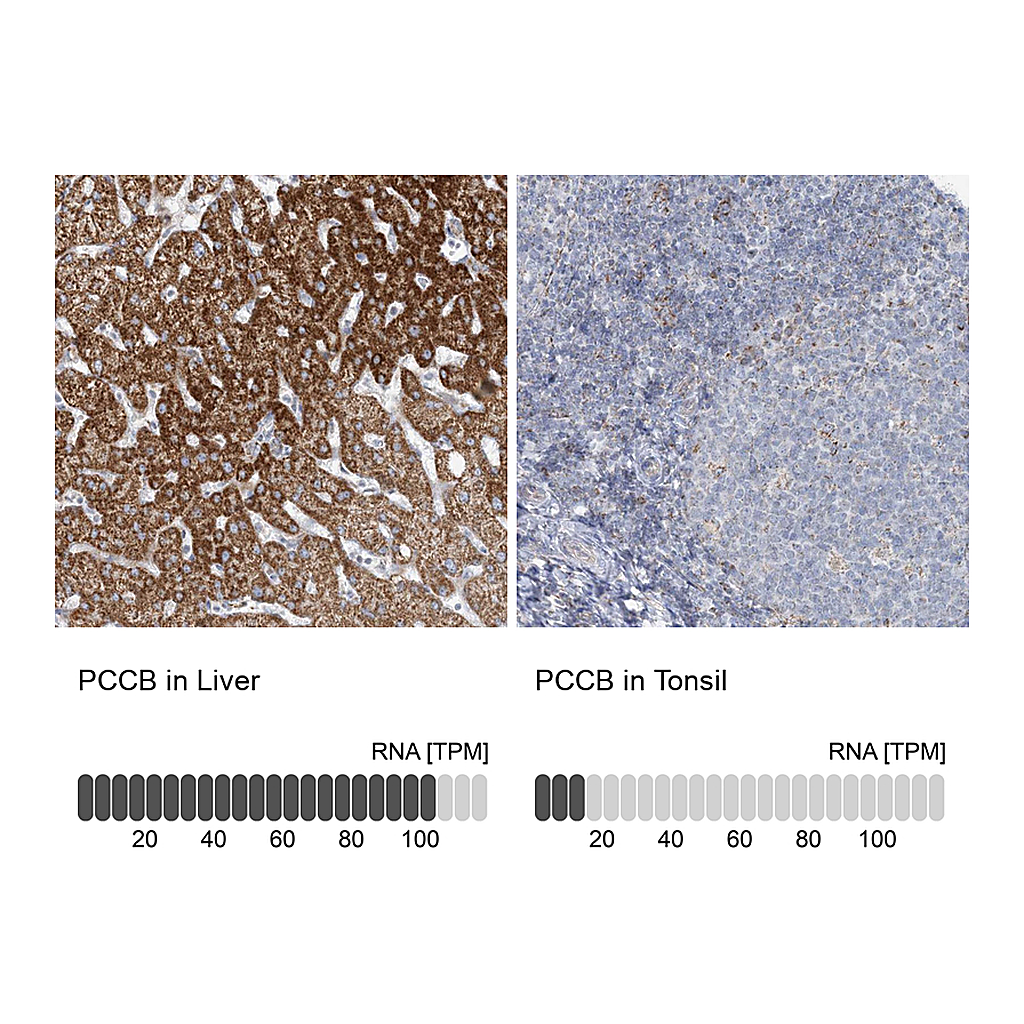 Atlas Antibodies Anti-PCCB Antibody