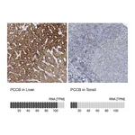 Atlas Antibodies Anti-PCCB Antibody