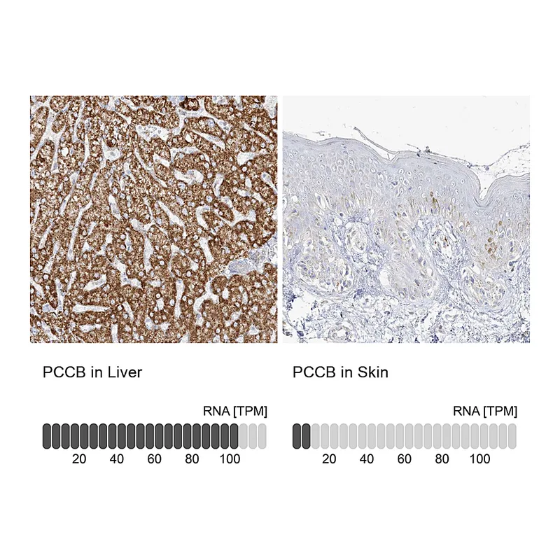 Atlas Antibodies Anti-PCCB Antibody