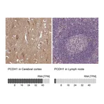 Atlas Antibodies Anti-PCDH1 Antibody