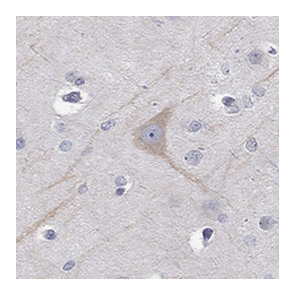 Atlas Antibodies Anti-PCDH11X Antibody