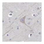 Atlas Antibodies Anti-PCDH11X Antibody