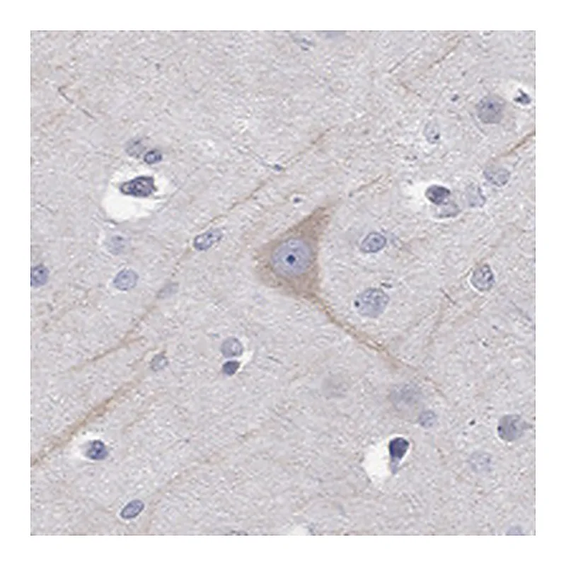 Atlas Antibodies Anti-PCDH11X Antibody