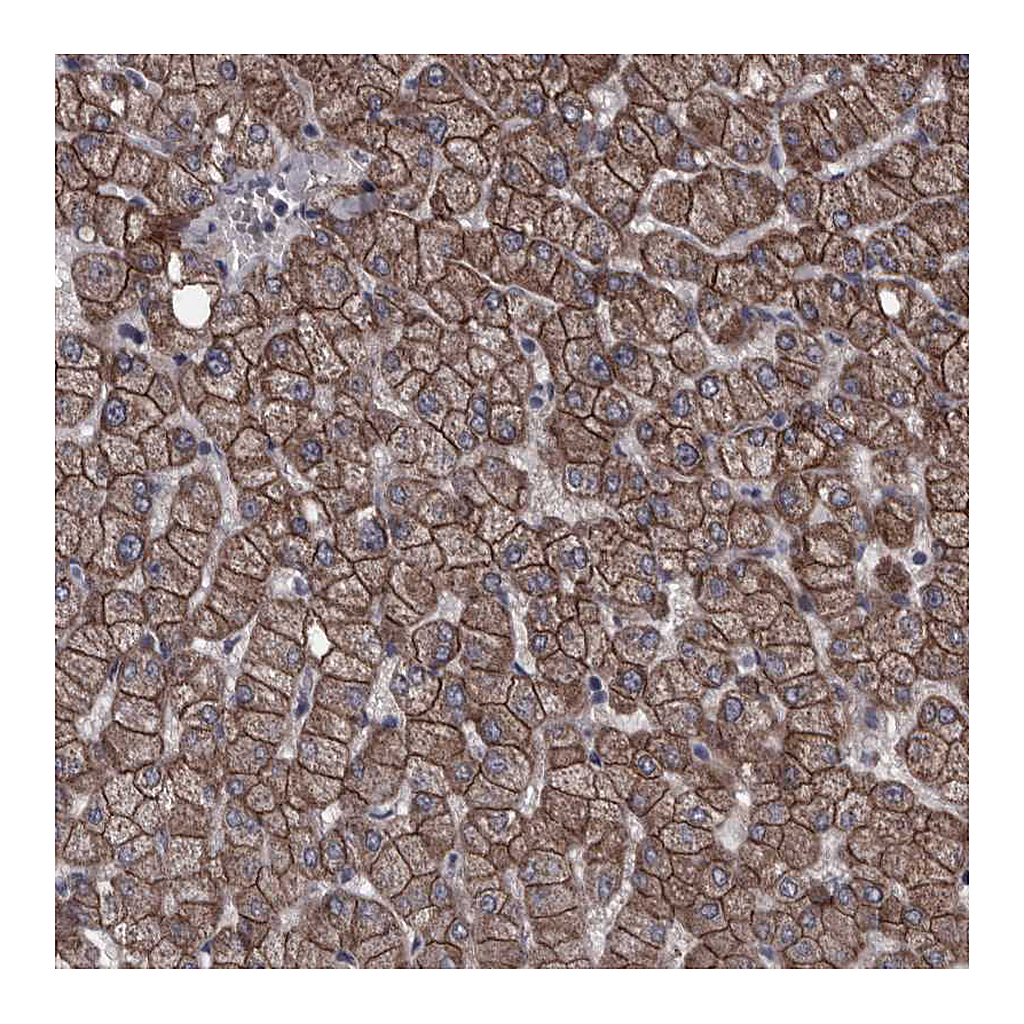 Atlas Antibodies Anti-PCDH17 Antibody