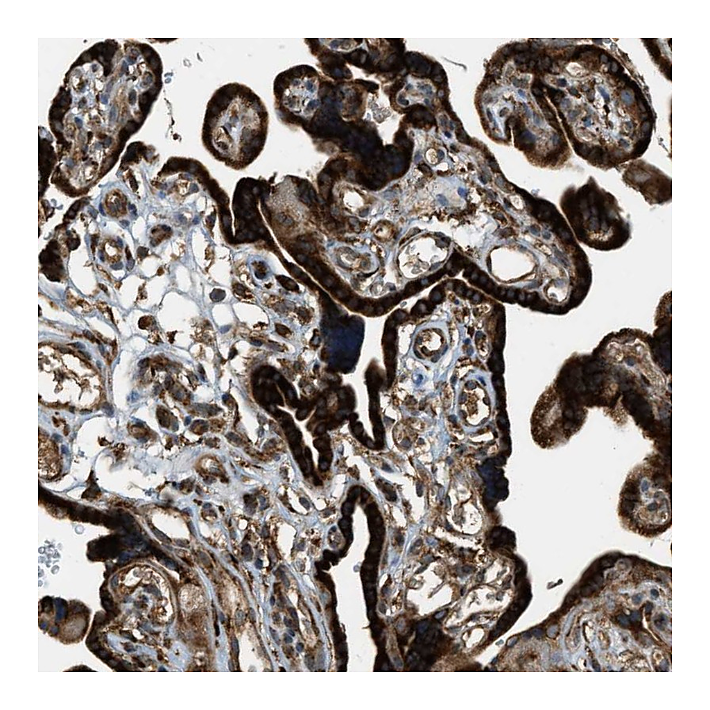 Atlas Antibodies Anti-PCDH18 Antibody