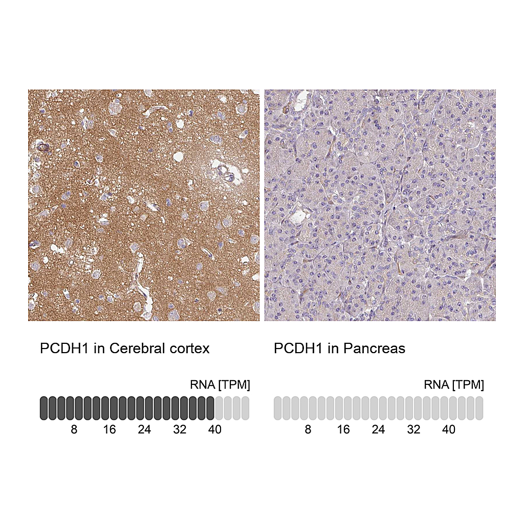 Atlas Antibodies Anti-PCDH1 Antibody