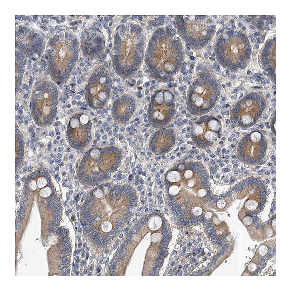 Atlas Antibodies Anti-PCDH8 Antibody
