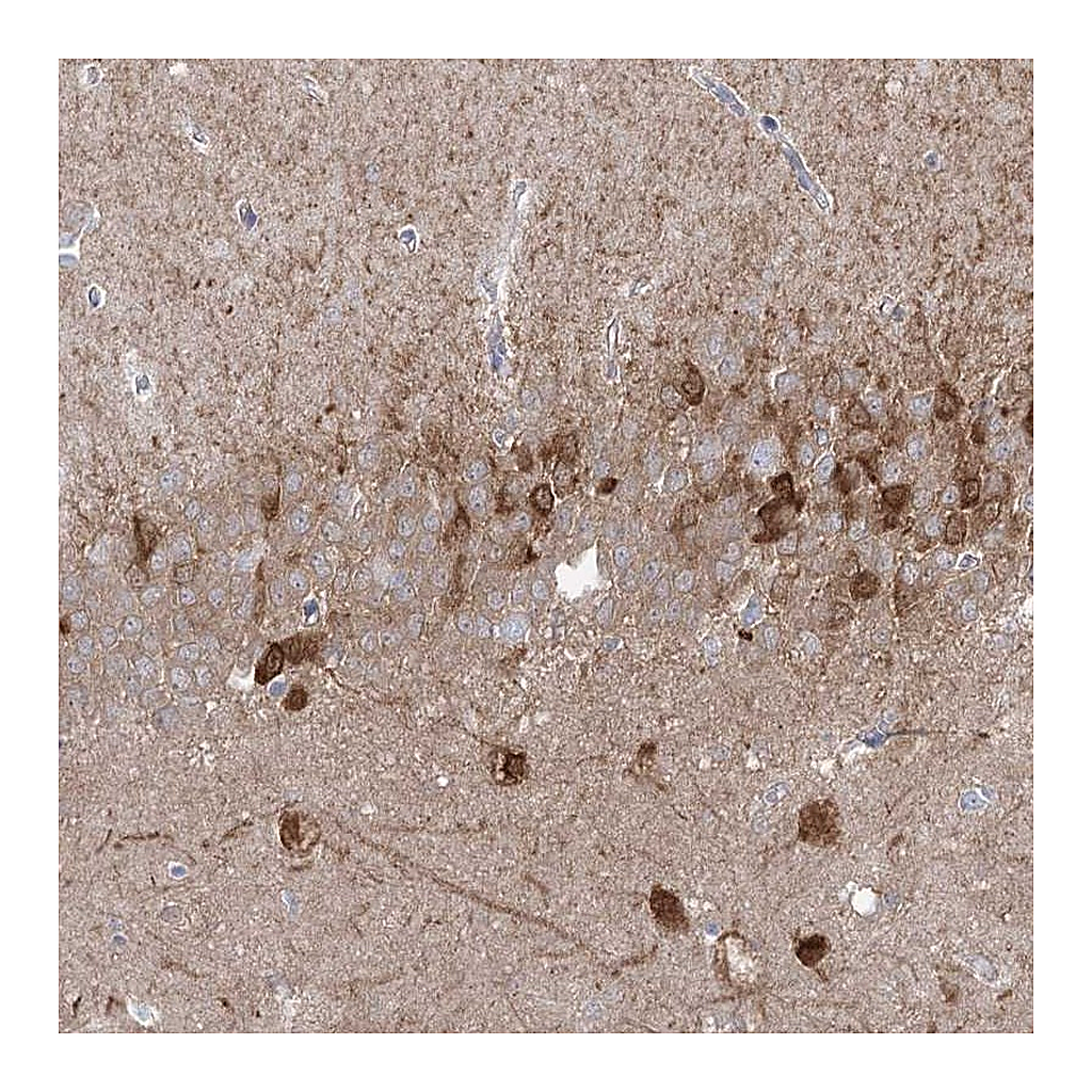 Atlas Antibodies Anti-PCDHA1 Antibody
