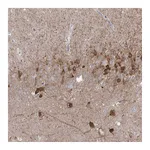Atlas Antibodies Anti-PCDHA1 Antibody