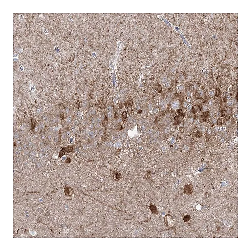 Atlas Antibodies Anti-PCDHA1 Antibody