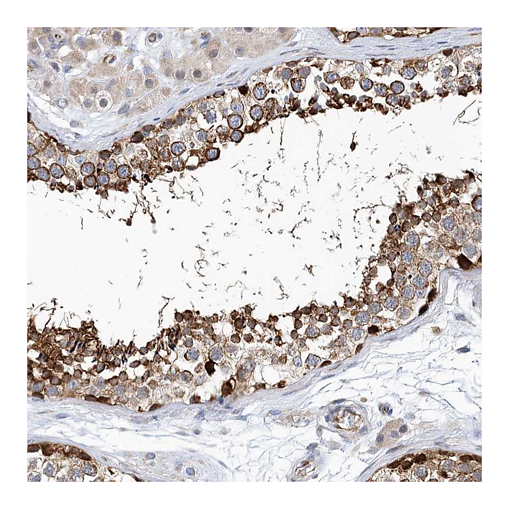 Atlas Antibodies Anti-PCDHA2 Antibody