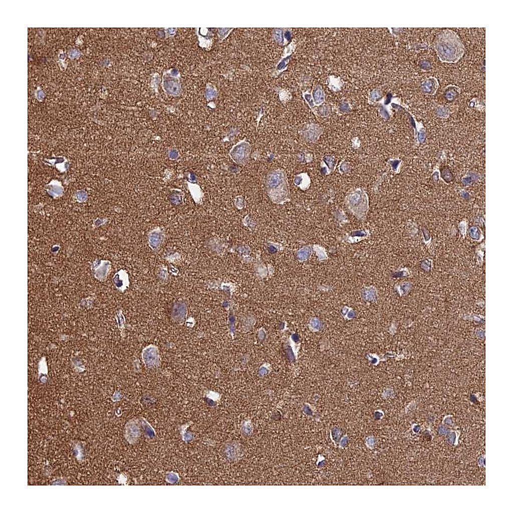 Atlas Antibodies Anti-PCDHA5 Antibody