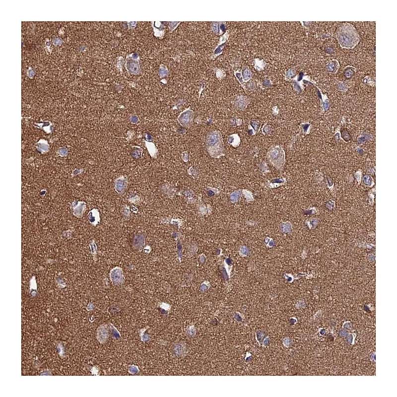 Atlas Antibodies Anti-PCDHA5 Antibody