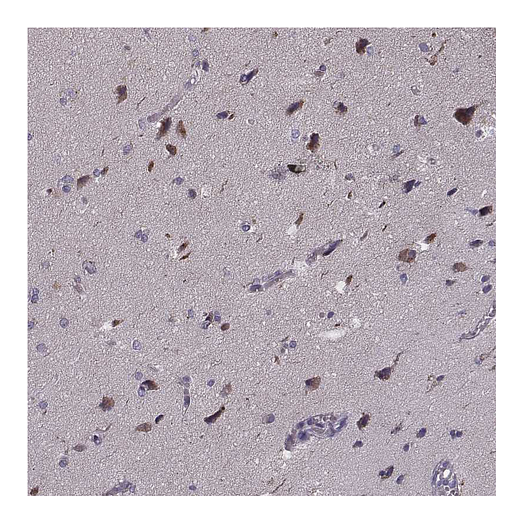 Atlas Antibodies Anti-PCDHA4 Antibody