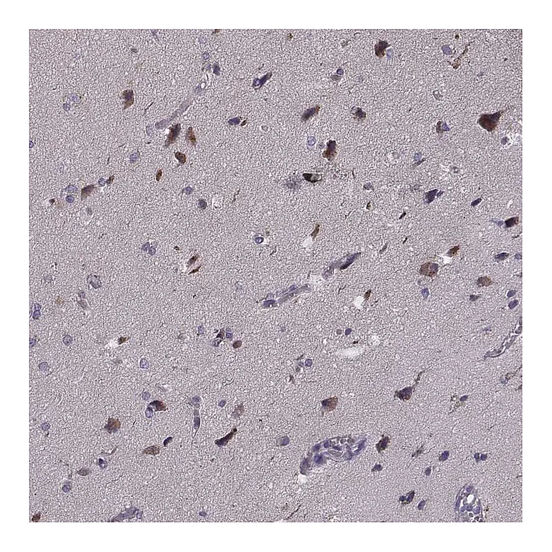 Atlas Antibodies Anti-PCDHA4 Antibody