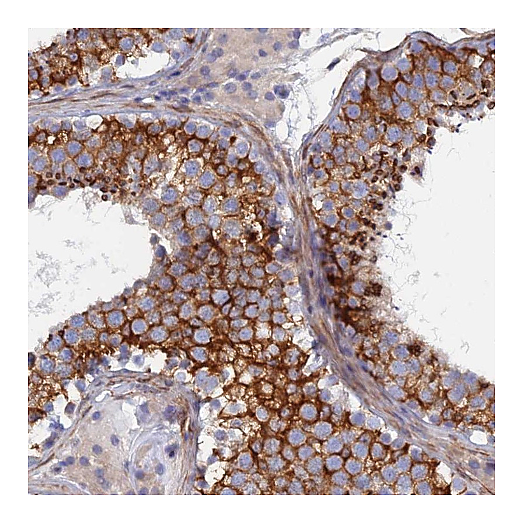 Atlas Antibodies Anti-PCDHA8 Antibody