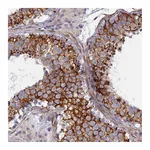 Atlas Antibodies Anti-PCDHA8 Antibody