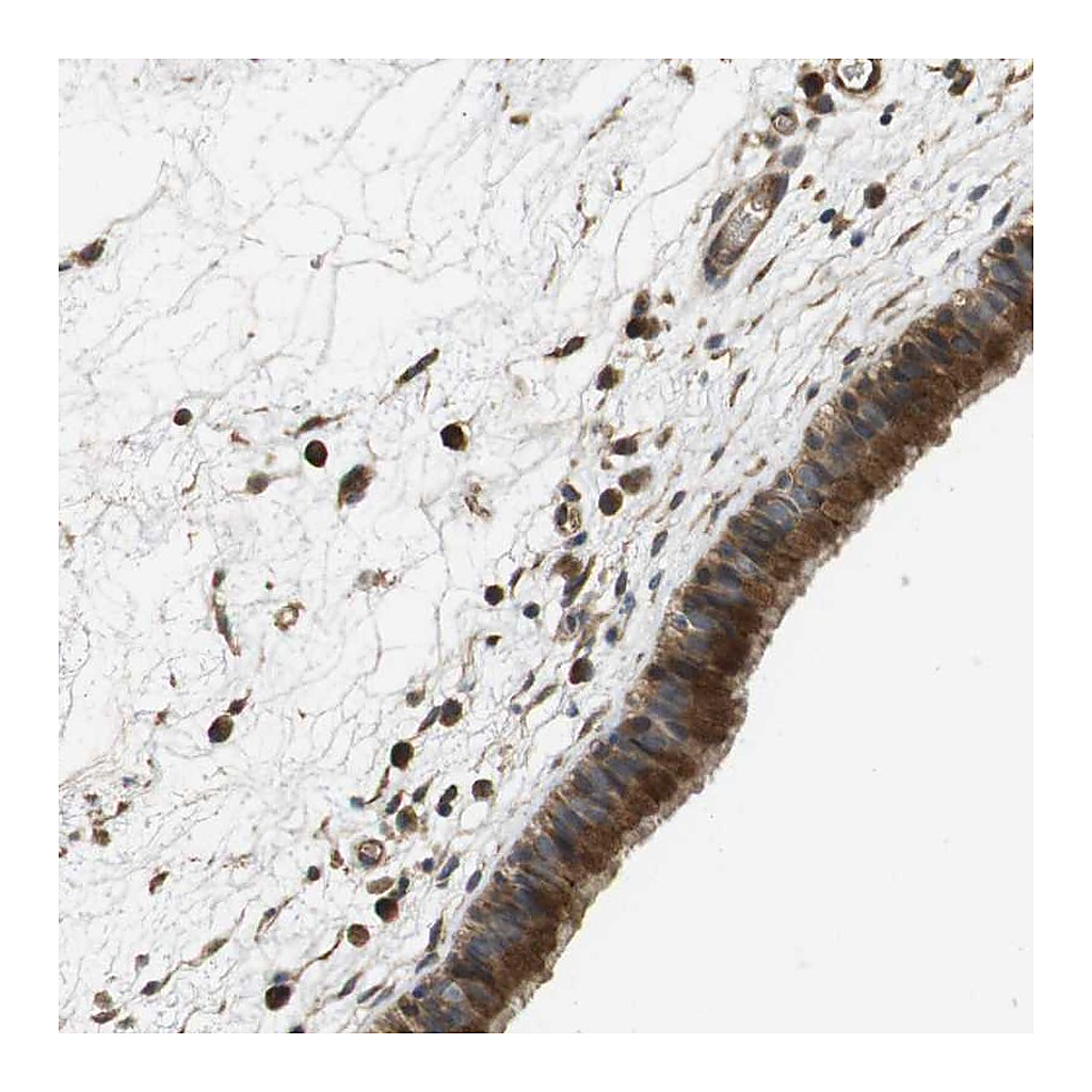 Atlas Antibodies Anti-PCDHB10 Antibody
