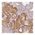 Atlas Antibodies Anti-PCDHB1 Antibody
