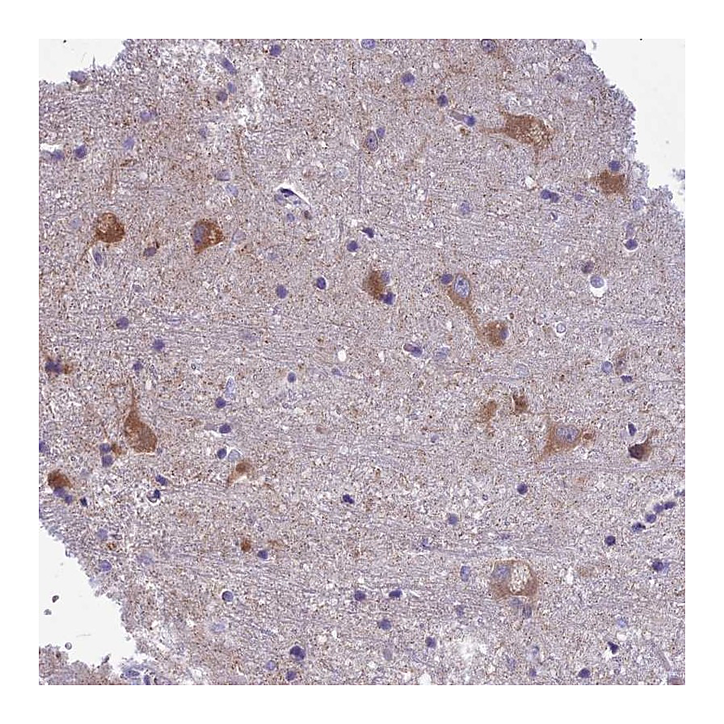 Atlas Antibodies Anti-PCDHB14 Antibody