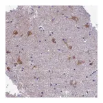 Atlas Antibodies Anti-PCDHB14 Antibody