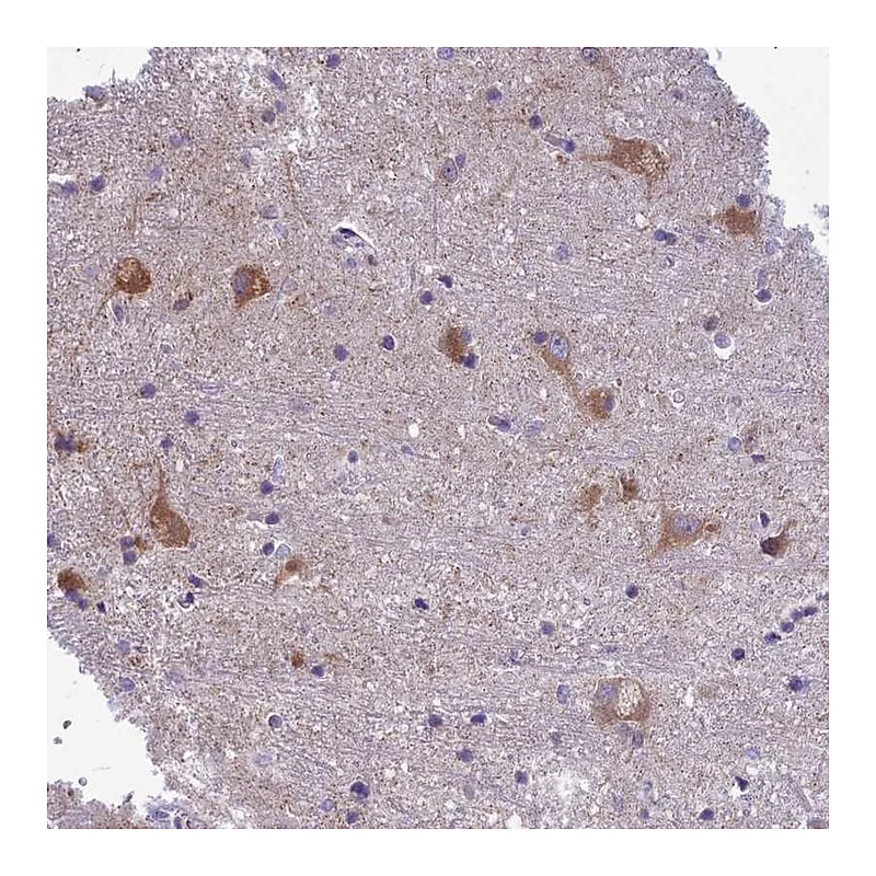 Atlas Antibodies Anti-PCDHB14 Antibody