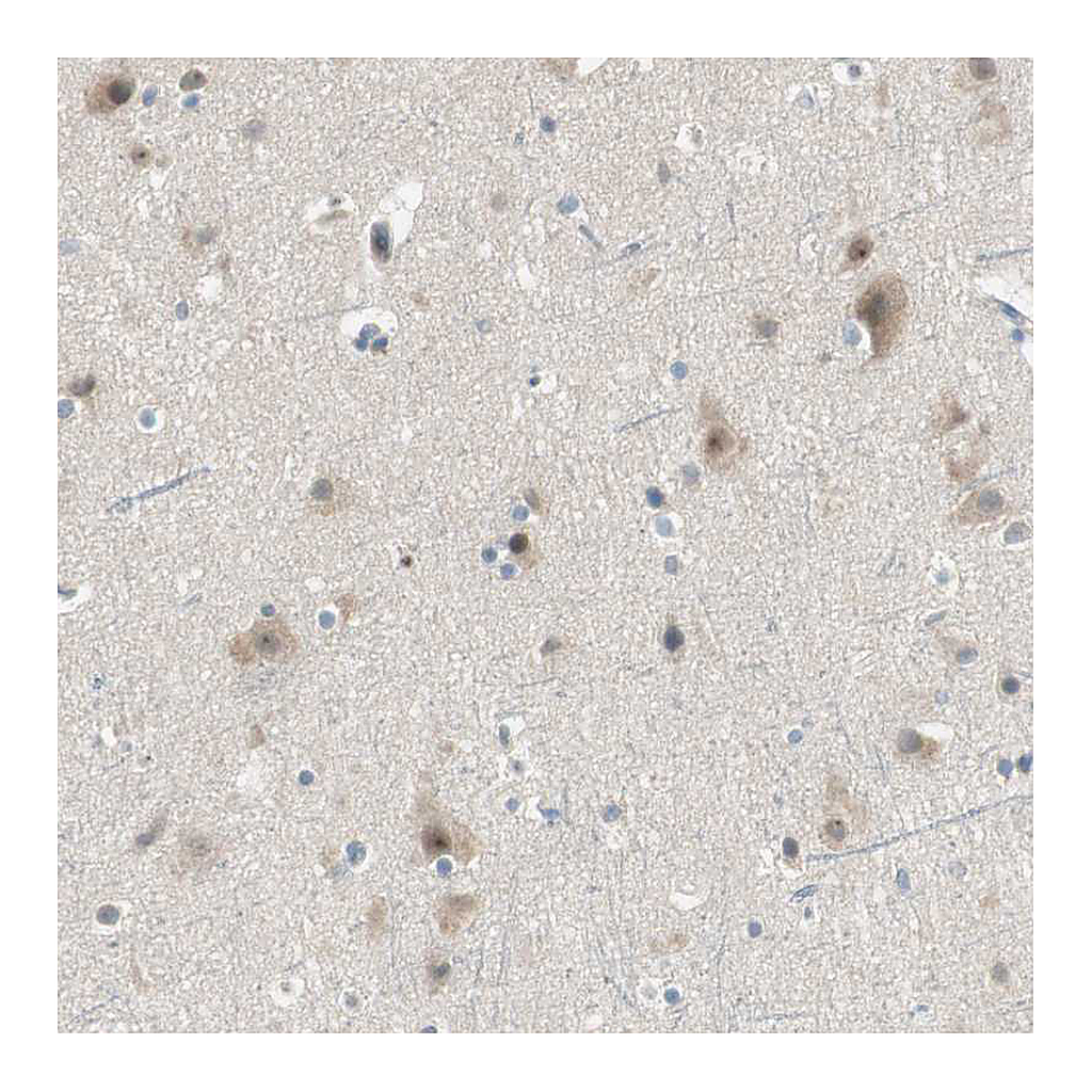 Atlas Antibodies Anti-PCDHB15 Antibody