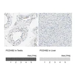 Atlas Antibodies Anti-PCDHB2 Antibody