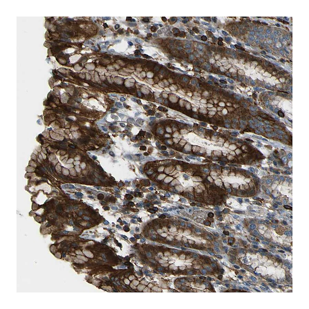 Atlas Antibodies Anti-PCDHB5 Antibody