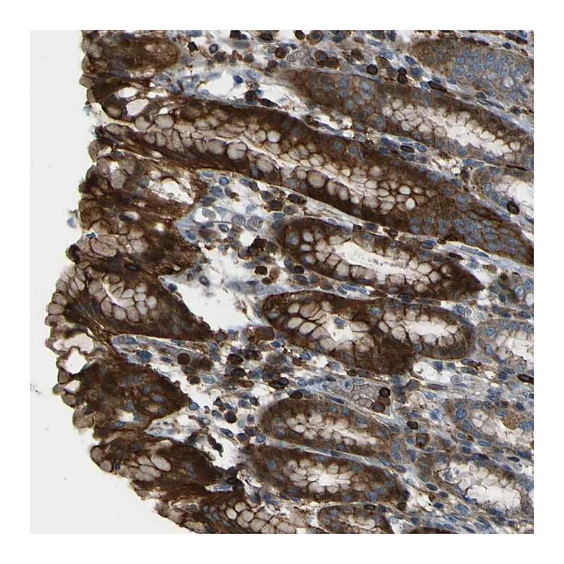 Atlas Antibodies Anti-PCDHB5 Antibody