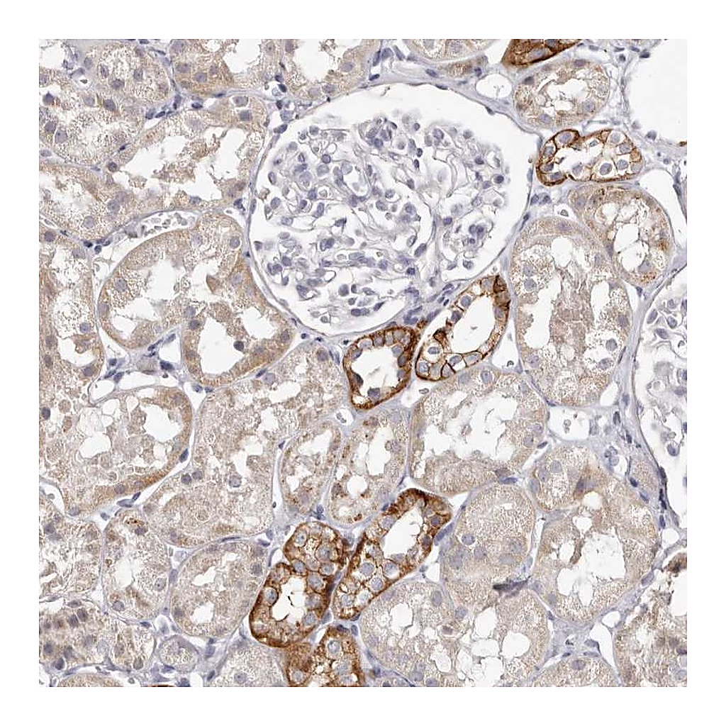 Atlas Antibodies Anti-PCDHB6 Antibody