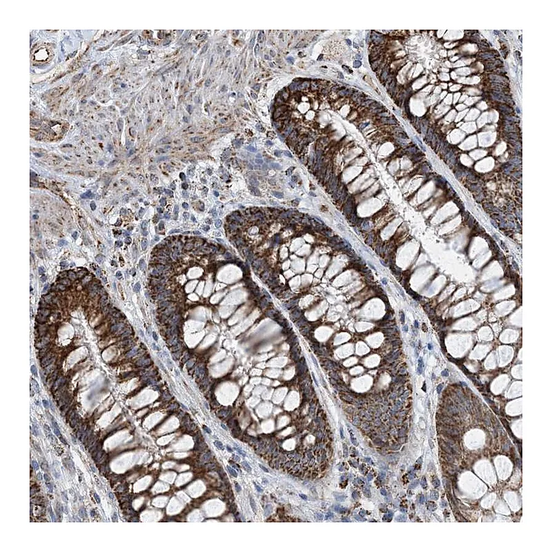 Atlas Antibodies Anti-PCDHGA1 Antibody
