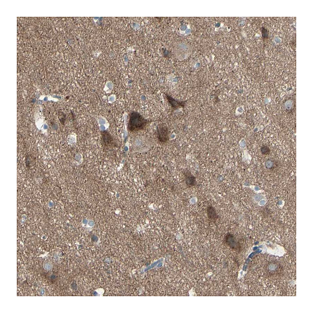 Atlas Antibodies Anti-PCDHGA2 Antibody