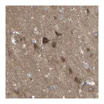 Atlas Antibodies Anti-PCDHGA2 Antibody