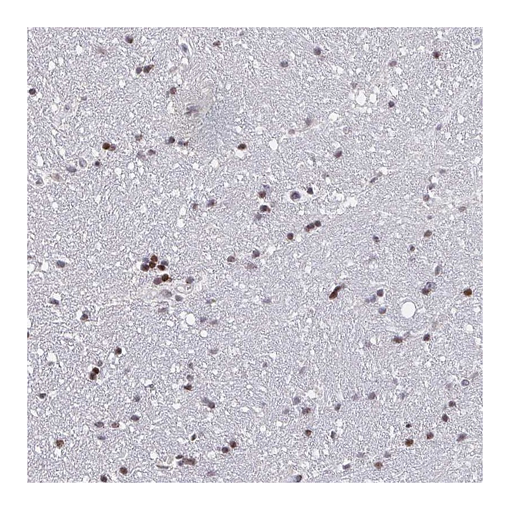 Atlas Antibodies Anti-PCDHB8 Antibody