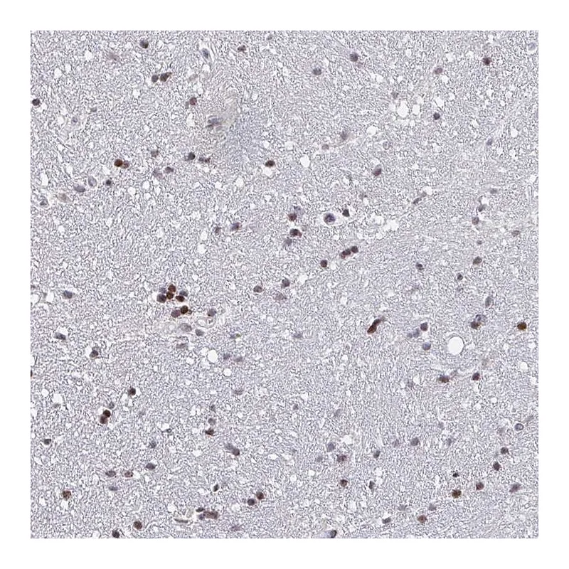 Atlas Antibodies Anti-PCDHB8 Antibody