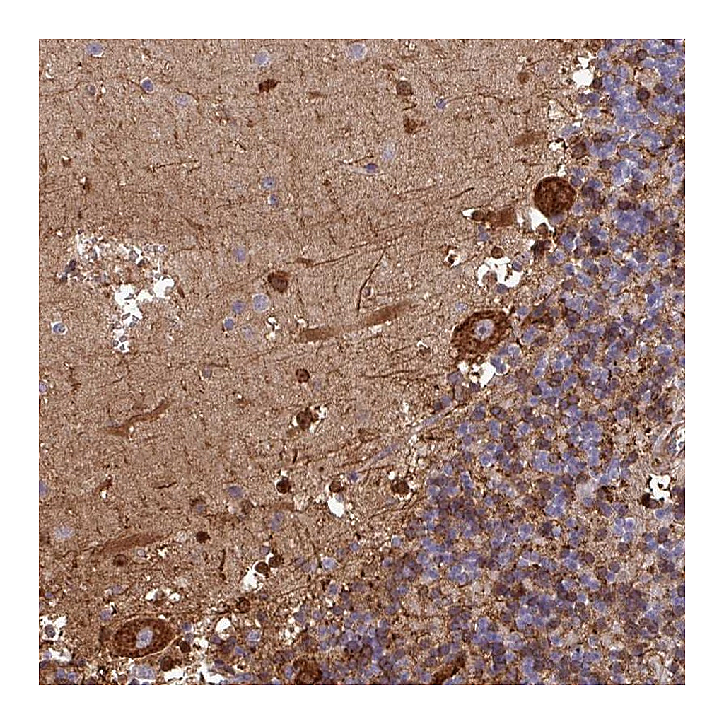 Atlas Antibodies Anti-PCED1A Antibody