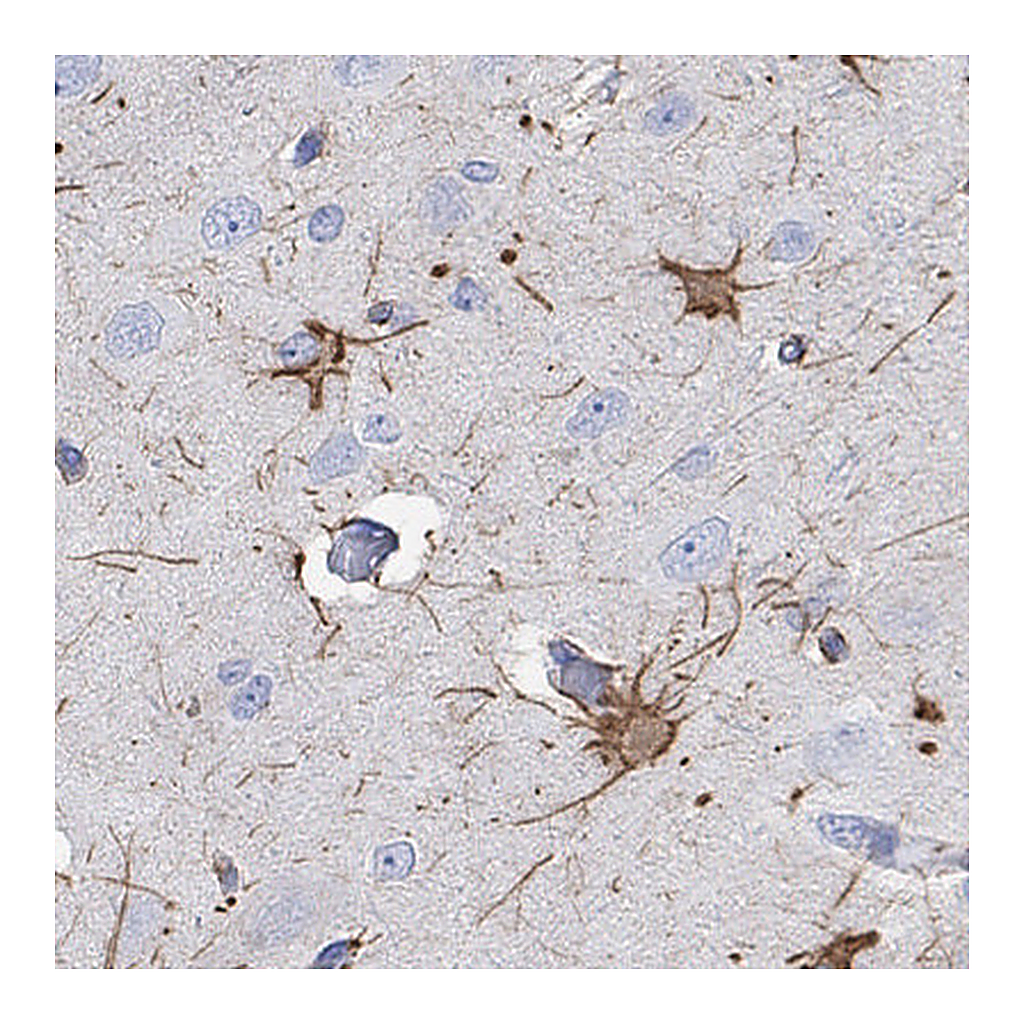 Atlas Antibodies Anti-PCDHGC5 Antibody