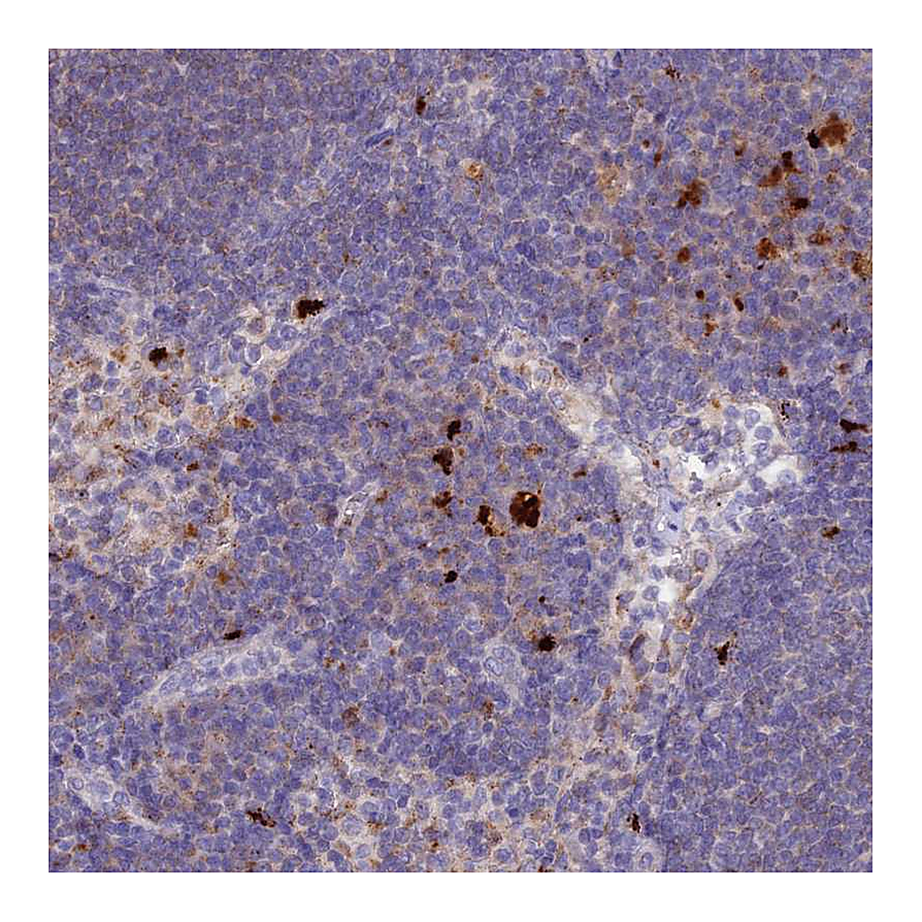 Atlas Antibodies Anti-PCED1B Antibody