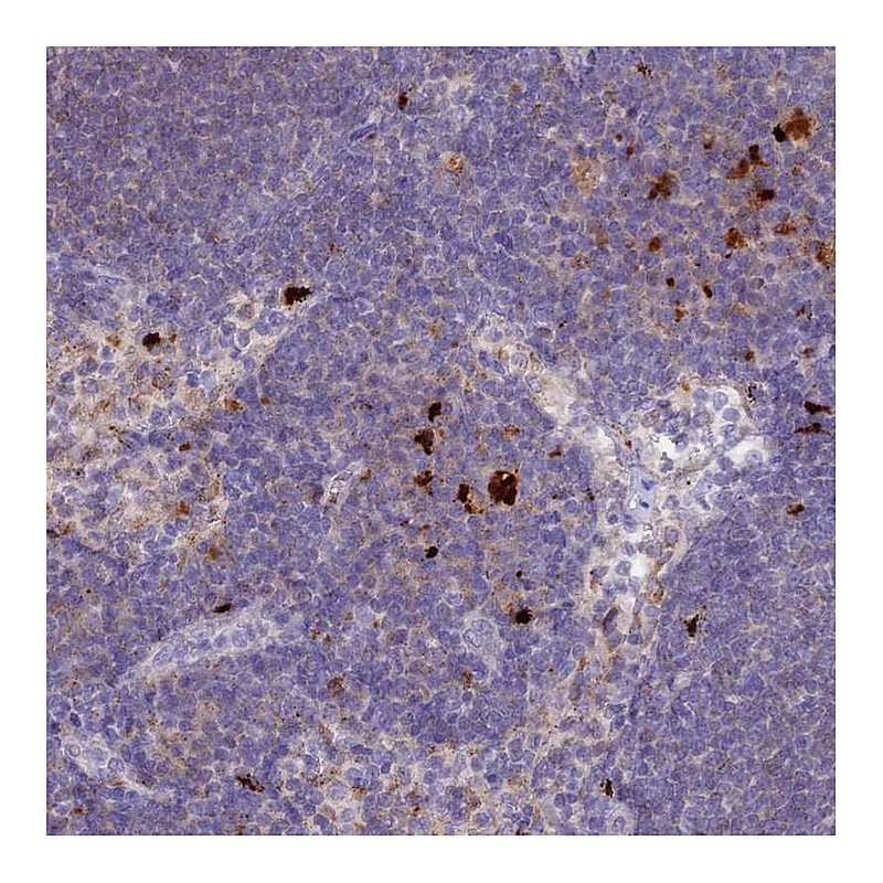 Atlas Antibodies Anti-PCED1B Antibody