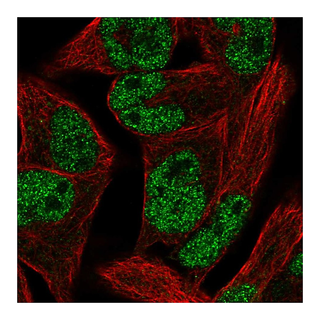 Atlas Antibodies Anti-PCGF1 Antibody