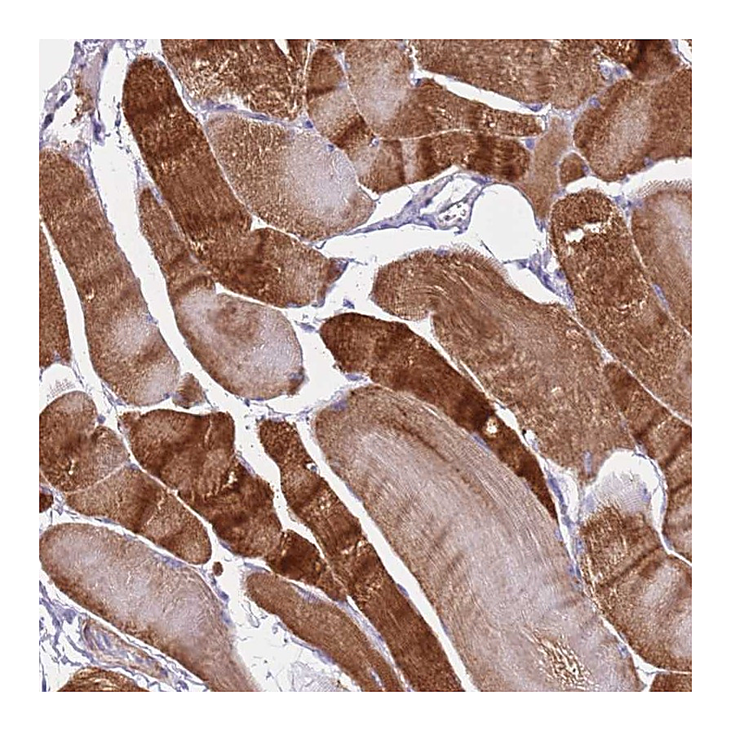Atlas Antibodies Anti-PCGF2 Antibody