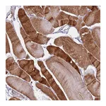 Atlas Antibodies Anti-PCGF2 Antibody